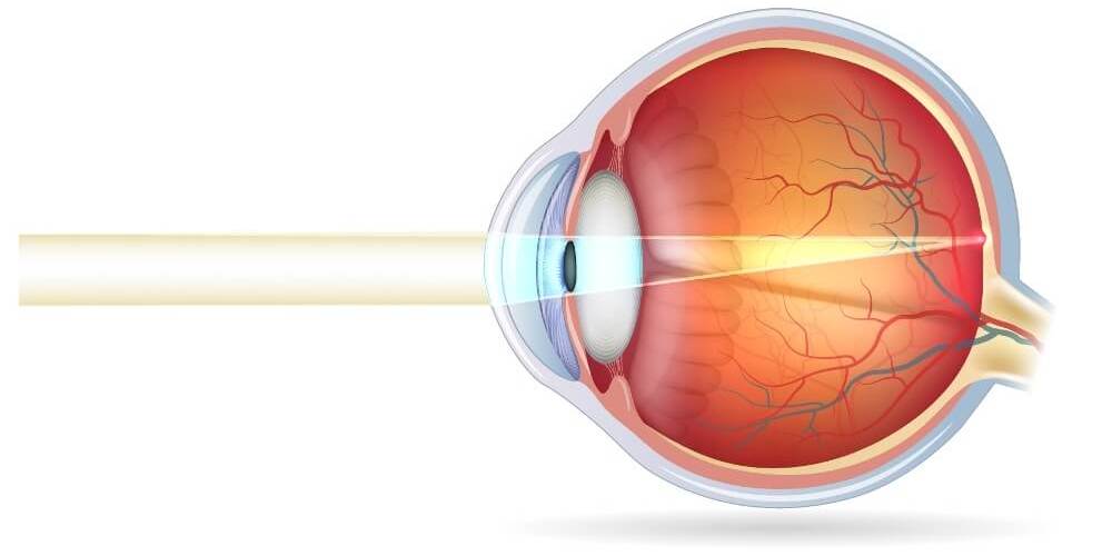 © Tefi/Shutterstock Die schematische Darstellung eines normalsichtigen Auges